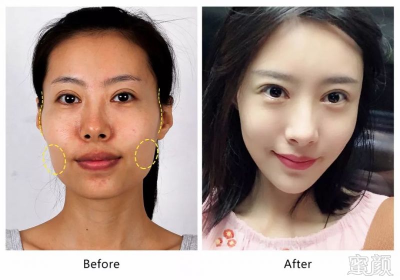 https://img.miyanlife.com/mnt/timg/190809/123Z62X5-14.jpg