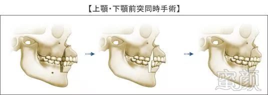 案例图片