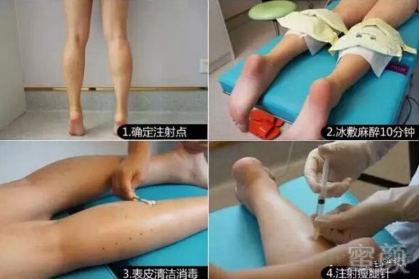 https://img.miyanlife.com/mnt/timg/190809/124HIE5-5.jpg