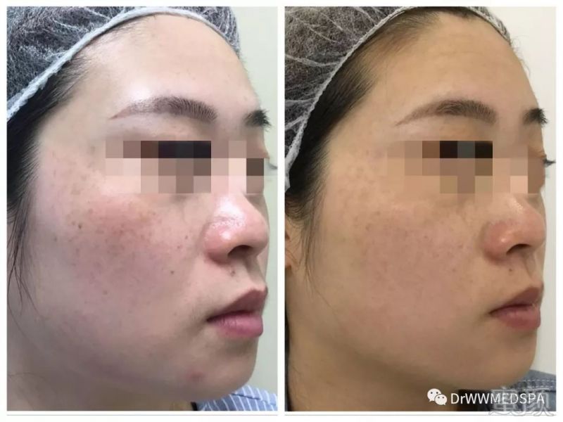 https://img.miyanlife.com/mnt/timg/190810/1153091596-1.jpg