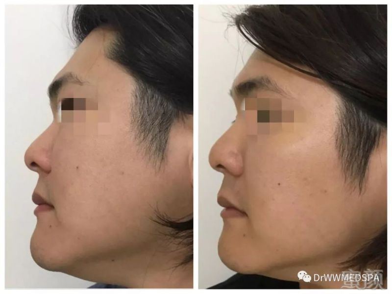 https://img.miyanlife.com/mnt/timg/190810/11531UC8-5.jpg