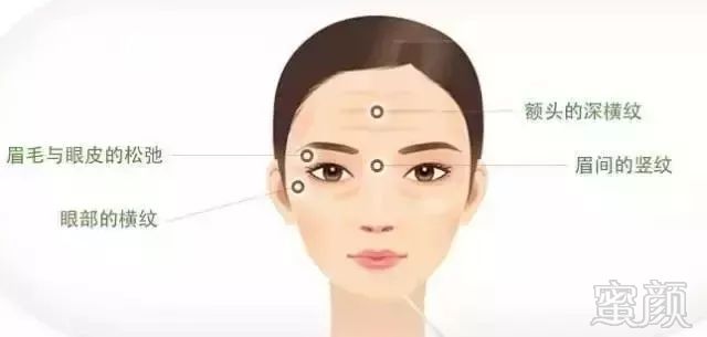 https://img.miyanlife.com/mnt/timg/190810/1156096262-3.jpg