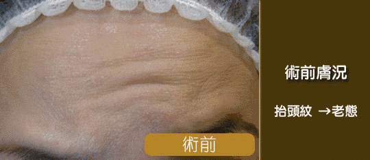 https://img.miyanlife.com/mnt/timg/190810/11561LN3-10.jpg