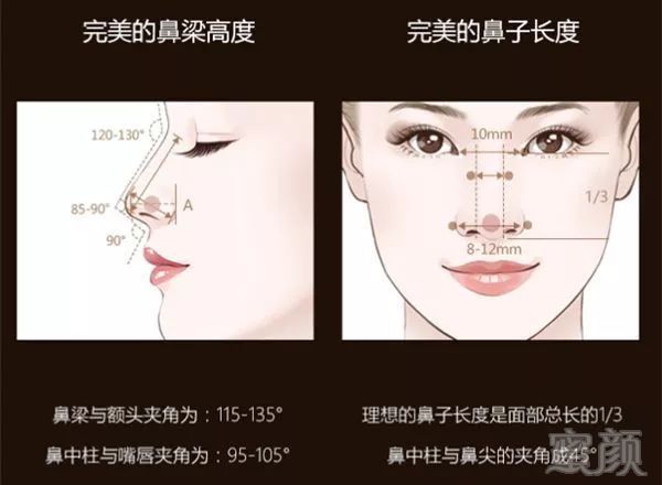 https://img.miyanlife.com/mnt/timg/190810/1254415054-3.jpg