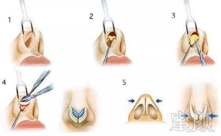 https://img.miyanlife.com/mnt/timg/190810/125442GC-6.jpg
