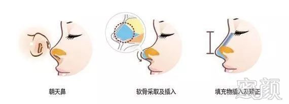 https://img.miyanlife.com/mnt/timg/190810/1254434633-7.jpg