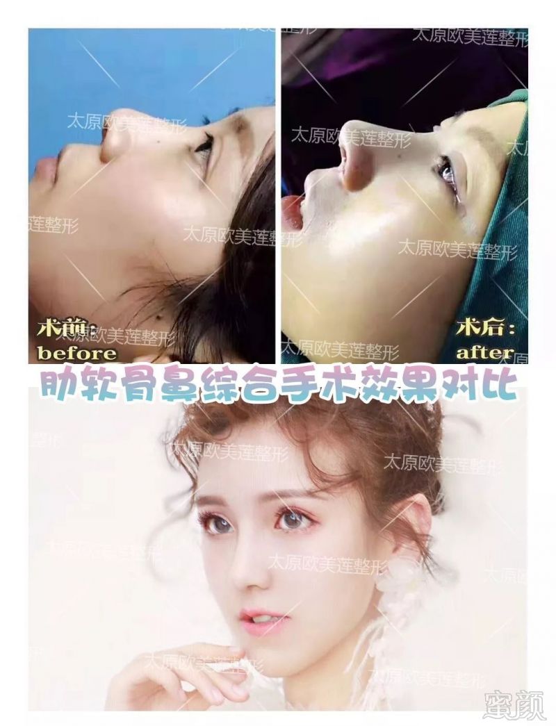 https://img.miyanlife.com/mnt/timg/190811/115A11551-1.jpg