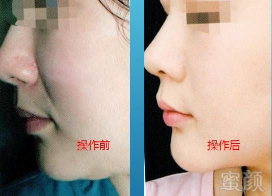 https://img.miyanlife.com/mnt/timg/190811/12541I044-18.jpg