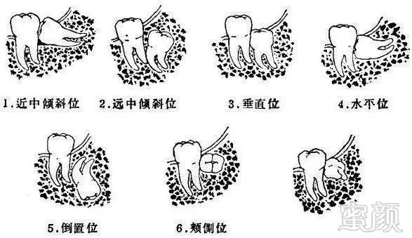 案例图片