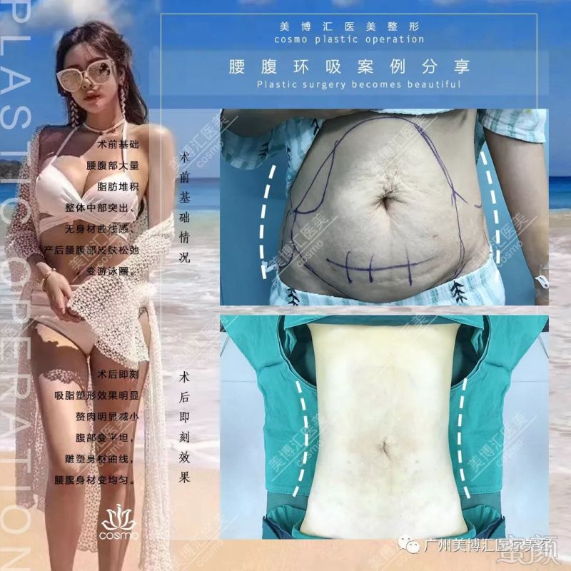 https://img.miyanlife.com/mnt/timg/190812/12144944Z-2.jpg