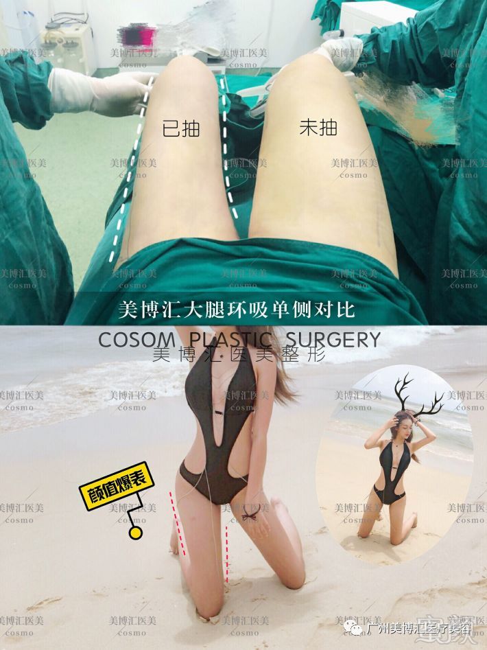 https://img.miyanlife.com/mnt/timg/190812/1214495J3-1.jpg