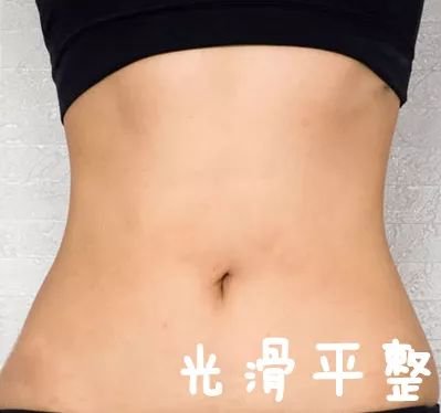 https://img.miyanlife.com/mnt/timg/190812/122U02552-9.jpg