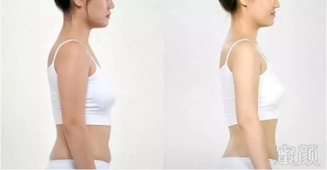 https://img.miyanlife.com/mnt/timg/190812/122U212X-12.jpg