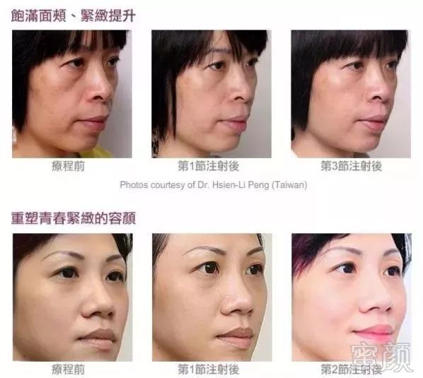 https://img.miyanlife.com/mnt/timg/190812/123J3GM-16.jpg