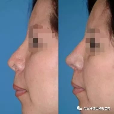 https://img.miyanlife.com/mnt/timg/190812/12451310V-7.jpg