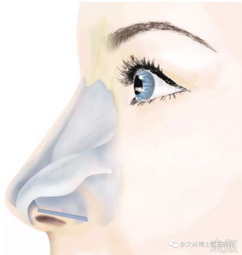 https://img.miyanlife.com/mnt/timg/190812/12451351Z-6.jpg