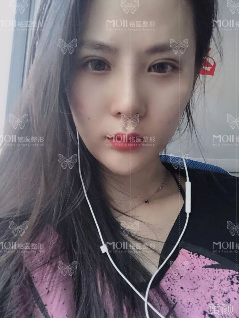 https://img.miyanlife.com/mnt/timg/190812/13053130H-17.jpg