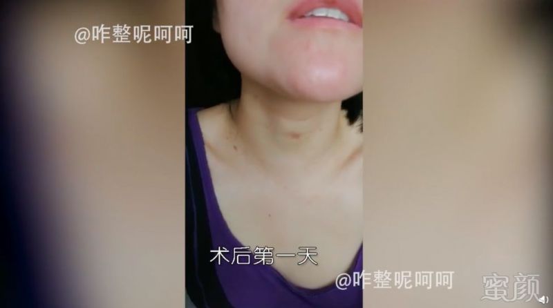 https://img.miyanlife.com/mnt/timg/190813/1232191913-15.jpg