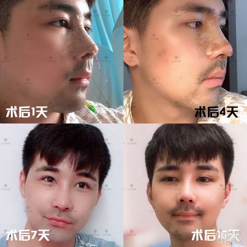 https://img.miyanlife.com/mnt/timg/190813/123G92U0-13.jpg