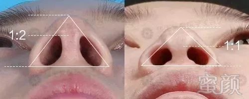 https://img.miyanlife.com/mnt/timg/190813/123GAL3-11.jpg