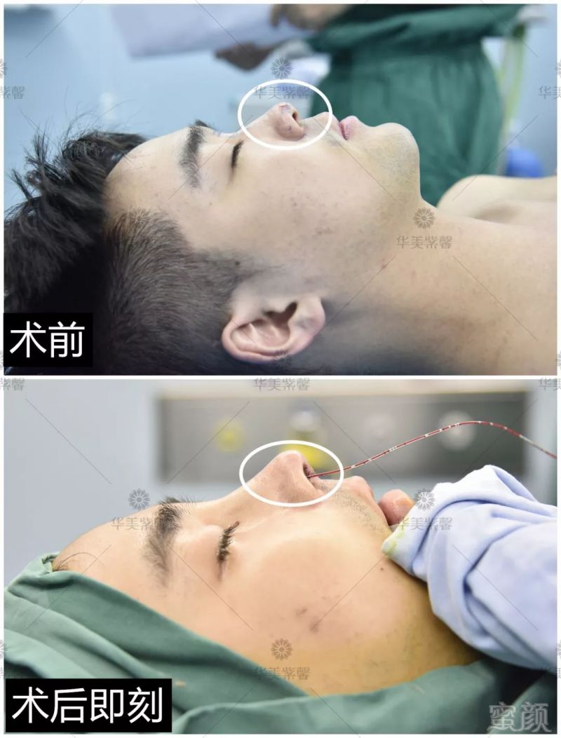 https://img.miyanlife.com/mnt/timg/190813/123GIJ8-12.jpg