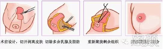 案例图片