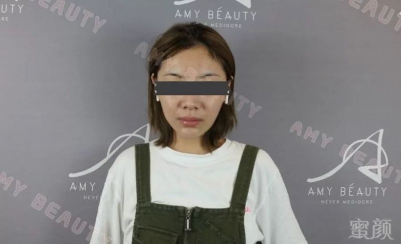 https://img.miyanlife.com/mnt/timg/190813/12443432H-5.jpg