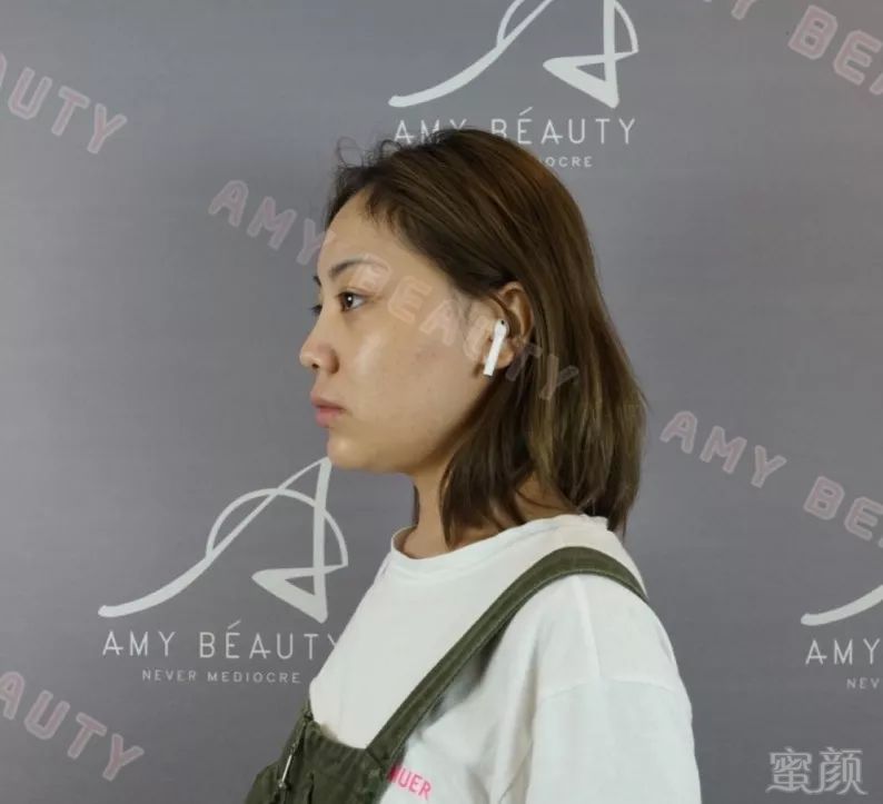 https://img.miyanlife.com/mnt/timg/190813/12443T5Y-7.jpg