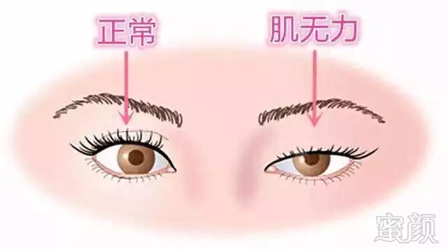 https://img.miyanlife.com/mnt/timg/190813/13144232V-13.jpg