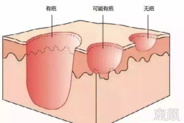 https://img.miyanlife.com/mnt/timg/190813/1314443I1-18.jpg