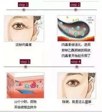 https://img.miyanlife.com/mnt/timg/190814/12542U202-2.jpg