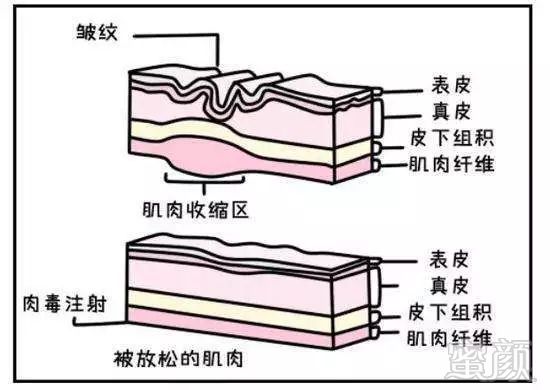 案例图片