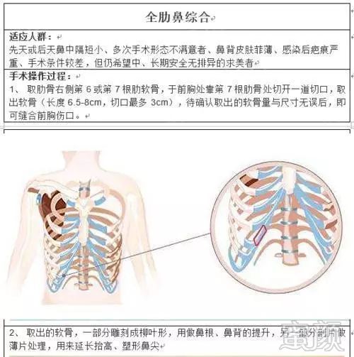 https://img.miyanlife.com/mnt/timg/190814/1302192536-0.jpg