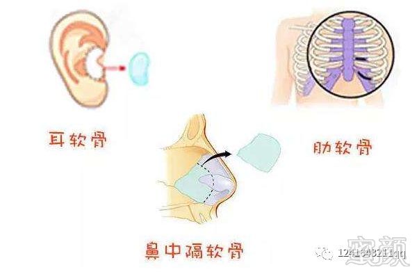 https://img.miyanlife.com/mnt/timg/190815/1422016404-0.jpg
