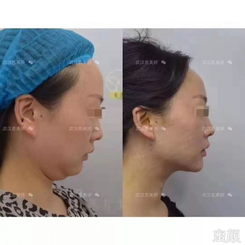 https://img.miyanlife.com/mnt/timg/190815/14222L415-1.jpg