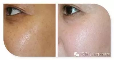 https://img.miyanlife.com/mnt/timg/190815/14413AC4-0.jpg