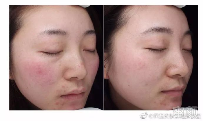 https://img.miyanlife.com/mnt/timg/190817/150KK251-0.jpg