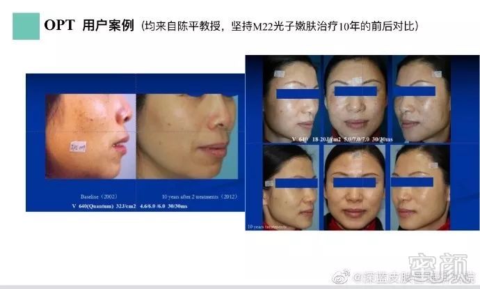 https://img.miyanlife.com/mnt/timg/190817/150P01M3-5.jpg