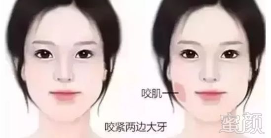 https://img.miyanlife.com/mnt/timg/190818/1055291518-1.jpg