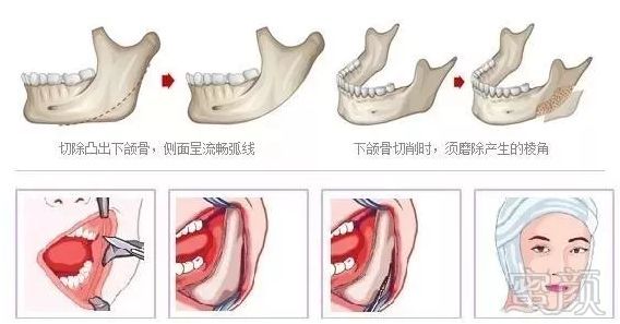 https://img.miyanlife.com/mnt/timg/190818/1055293V9-2.jpg