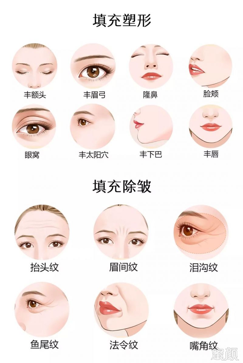 https://img.miyanlife.com/mnt/timg/190819/122U55394-1.jpg