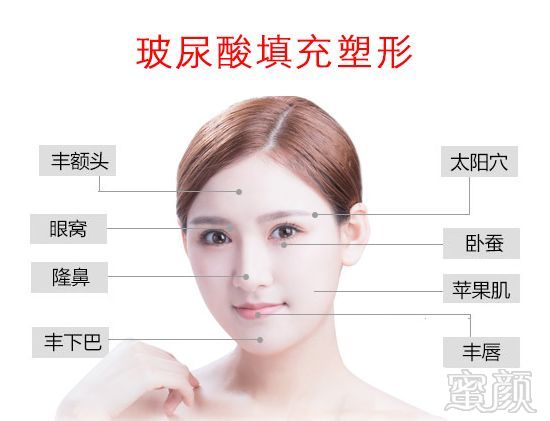 https://img.miyanlife.com/mnt/timg/190819/122U61161-2.jpg