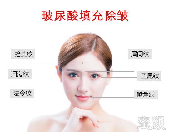 https://img.miyanlife.com/mnt/timg/190819/122UG5R-3.jpg