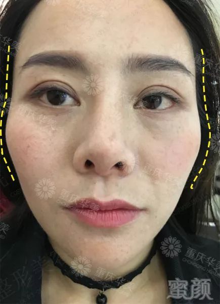 https://img.miyanlife.com/mnt/timg/190819/12361UY2-9.jpg