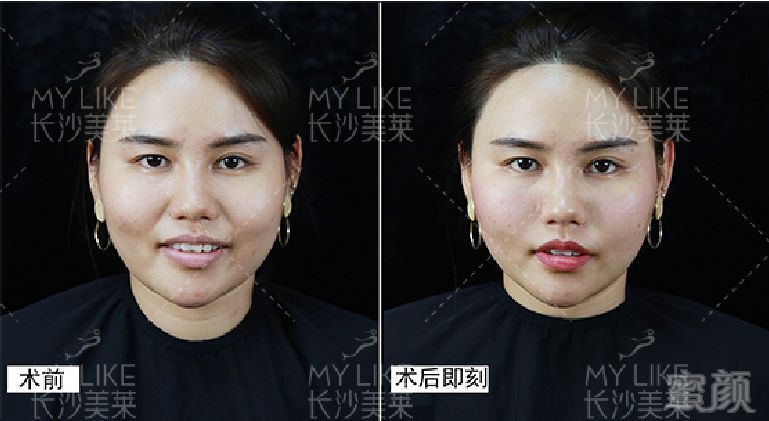https://img.miyanlife.com/mnt/timg/190820/124AL522-1.jpg