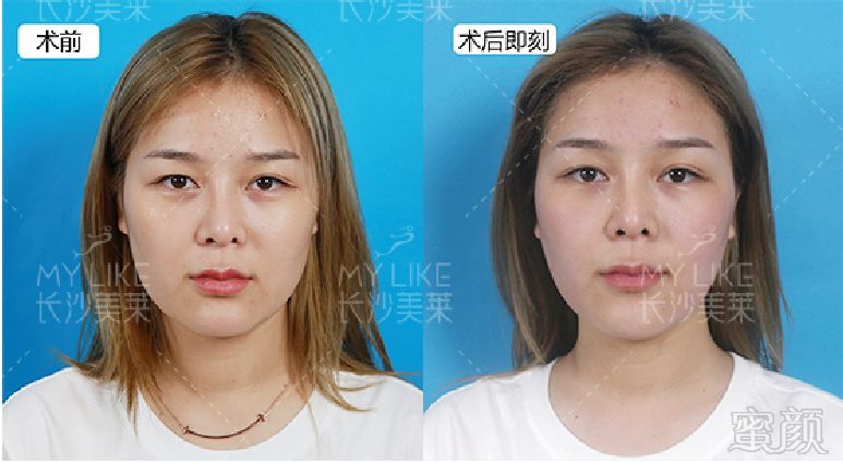 https://img.miyanlife.com/mnt/timg/190820/124AS225-2.jpg