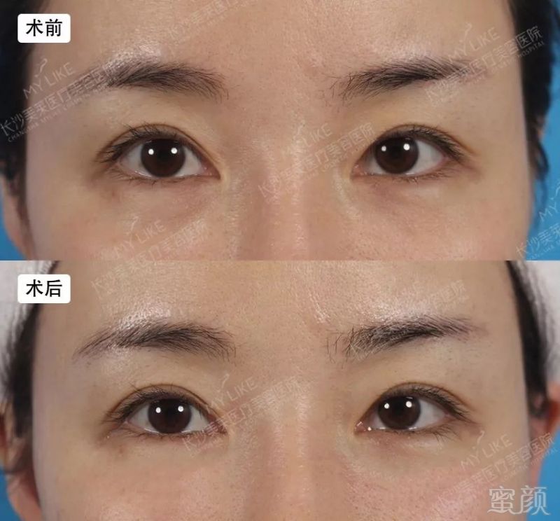 https://img.miyanlife.com/mnt/timg/190820/124AUI3-3.jpg