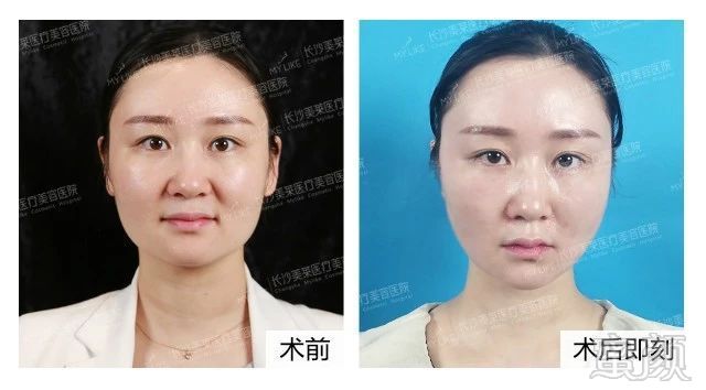 https://img.miyanlife.com/mnt/timg/190820/124F030S-5.jpg