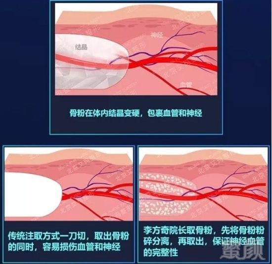 案例图片