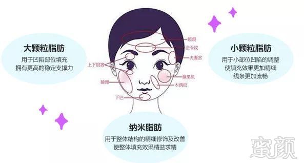 https://img.miyanlife.com/mnt/timg/190822/13443455a-9.jpg